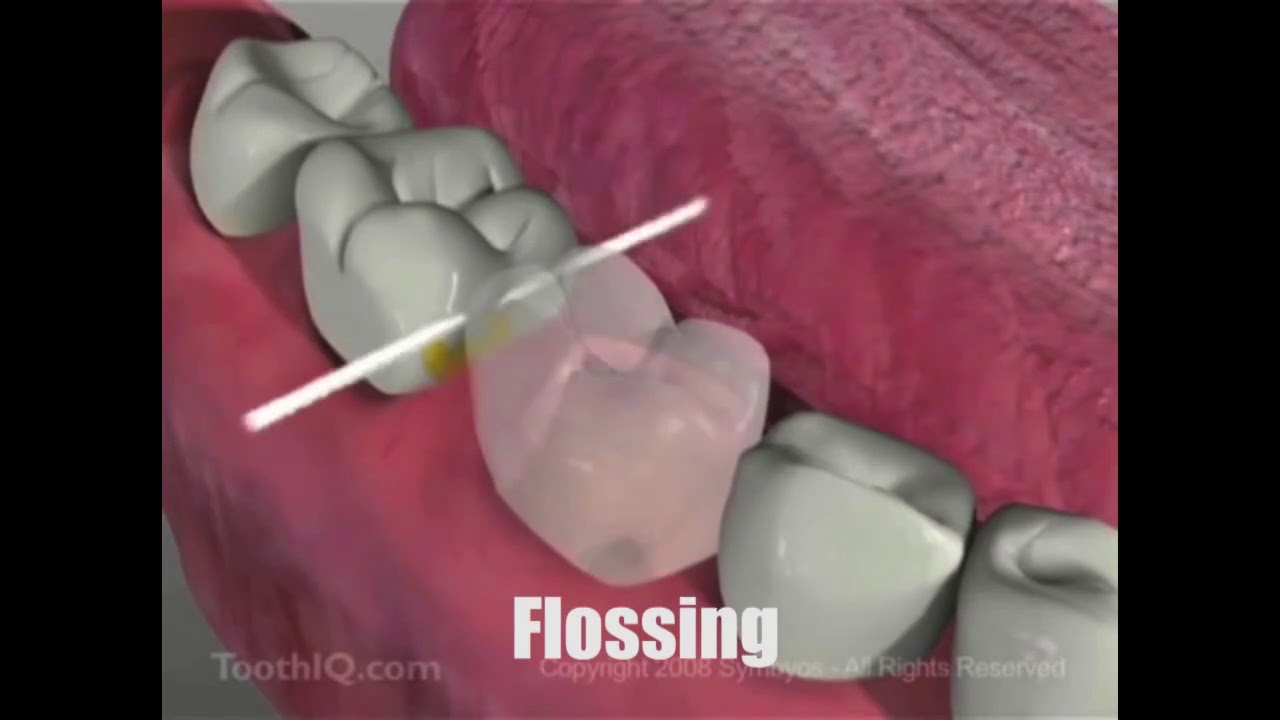 Dental Flossing – Dr. Charlene Reid